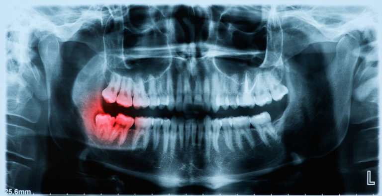 periodontist in Lexington KY