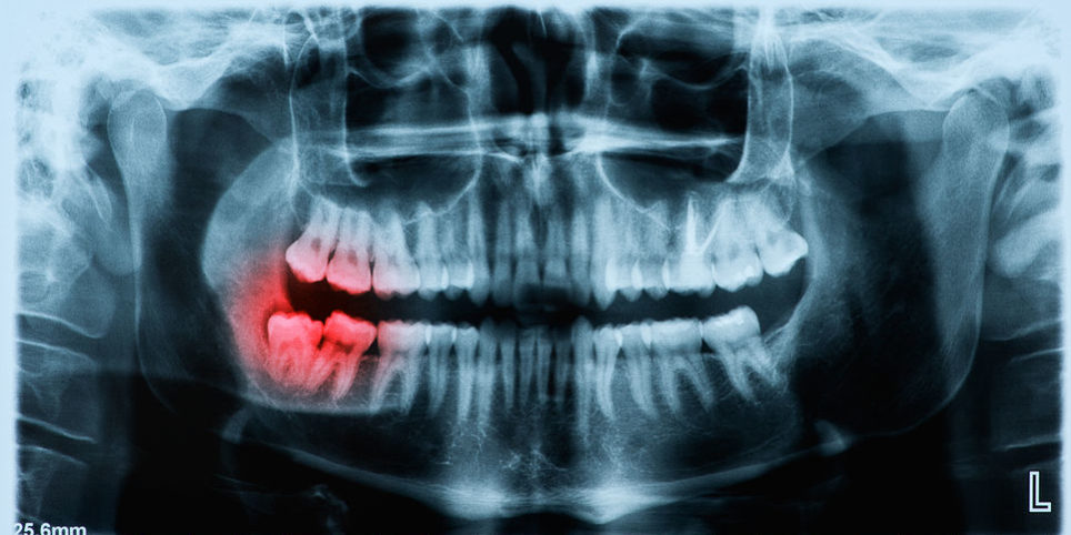 periodontist in Lexington KY