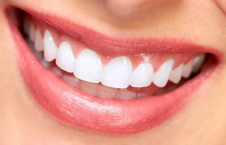 Smile. dental implants, periodontics