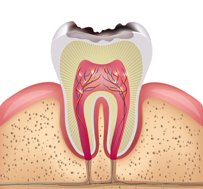 periodontal disease lexington ky