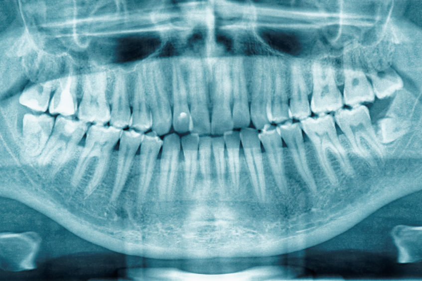 periodontic treatment lexington ky Dr. Homing Kim, DDS